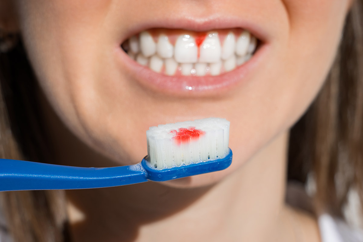 Periodontics