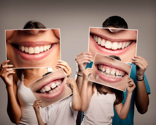 Smile Designing